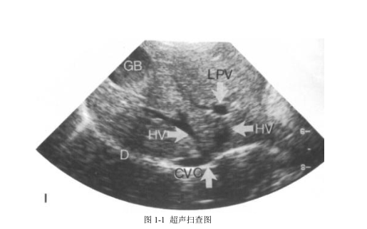 超声介绍