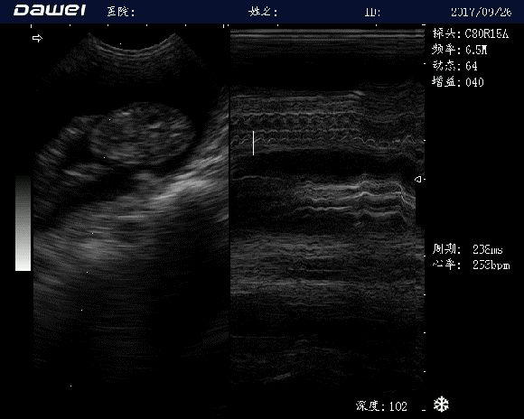 宠物M型超声