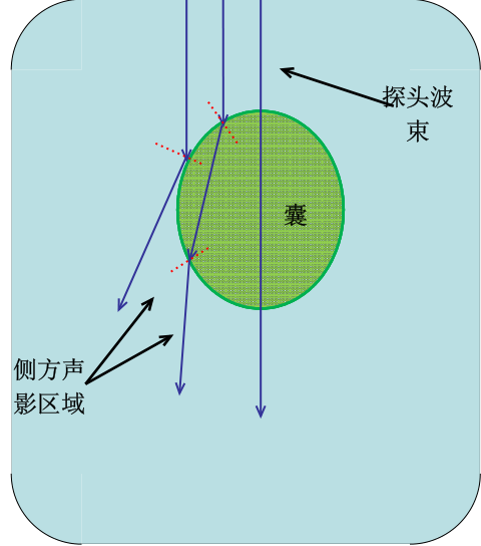 动物超声侧边声影