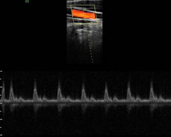 动物超声脉冲多普勒模式